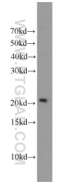 19825-1-AP - TMEM176B / LR8