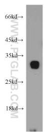 19207-1-AP - TMEM27 / Collectrin