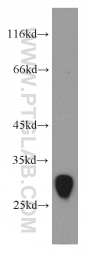 20768-1-AP - TMEM41A