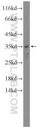 19918-1-AP - TMEM9