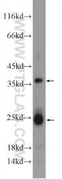 24331-1-AP - TMEM9B