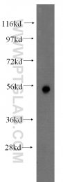 11283-1-AP - TMPRSS4