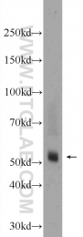 24616-1-AP - TMPRSS5 / Spinesin