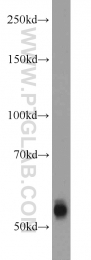 12950-1-AP - TMPRSS6