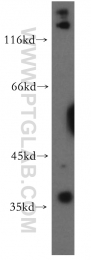 15320-1-AP - TNFAIP1 / EDP1