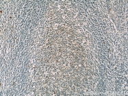 15790-1-AP - TNFAIP8