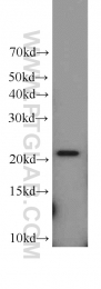 15790-1-AP - TNFAIP8
