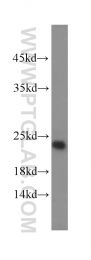 15790-1-AP - TNFAIP8