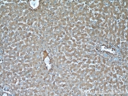 15459-1-AP - TNIP2