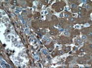 15459-1-AP - TNIP2