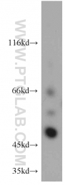 15459-1-AP - TNIP2