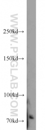 14304-1-AP - TNK2 / ACK1