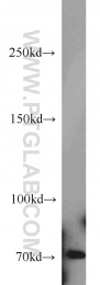 14304-1-AP - TNK2 / ACK1