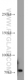 14304-1-AP - TNK2 / ACK1
