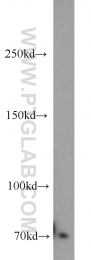 14304-1-AP - TNK2 / ACK1
