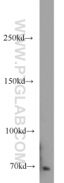 14304-1-AP - TNK2 / ACK1