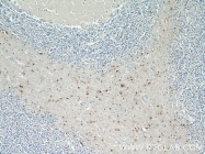 25353-1-AP - TNRC4 / BRUNOL1