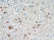 25353-1-AP - TNRC4 / BRUNOL1