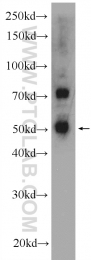 25353-1-AP - TNRC4 / BRUNOL1