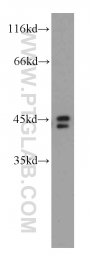 14915-1-AP - TOB1