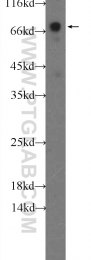 14528-1-AP - TOMM70A