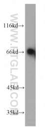 14528-1-AP - TOMM70A