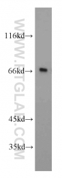 14528-1-AP - TOMM70A