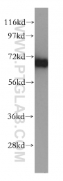 14528-1-AP - TOMM70A