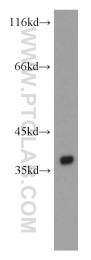 14828-1-AP - TP53I3
