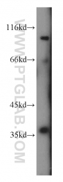 14828-1-AP - TP53I3