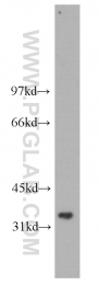 14828-1-AP - TP53I3