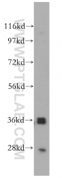 14828-1-AP - TP53I3