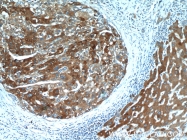 17872-1-AP - TP53INP1