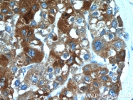 17872-1-AP - TP53INP1