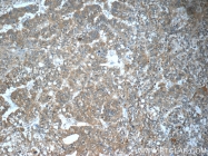17872-1-AP - TP53INP1