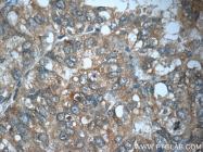17872-1-AP - TP53INP1