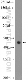 17872-1-AP - TP53INP1