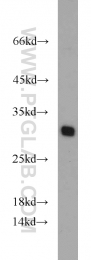 11795-1-AP - Tumor protein D54 (TPD52L2)