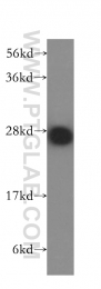 10713-1-AP - Triosephosphate isomerase (TPI1)