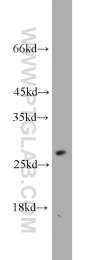 10713-1-AP - Triosephosphate isomerase (TPI1)