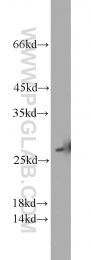 10713-1-AP - Triosephosphate isomerase (TPI1)