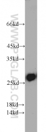 10713-1-AP - Triosephosphate isomerase (TPI1)