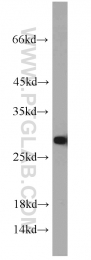 10713-1-AP - Triosephosphate isomerase (TPI1)