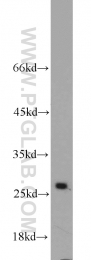 10713-1-AP - Triosephosphate isomerase (TPI1)