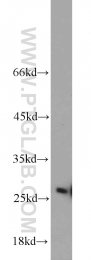 10713-1-AP - Triosephosphate isomerase (TPI1)