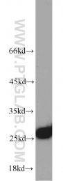 10713-1-AP - Triosephosphate isomerase (TPI1)