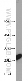 10713-1-AP - Triosephosphate isomerase (TPI1)