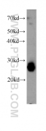 60036-2-Ig - Triosephosphate isomerase (TPI1)