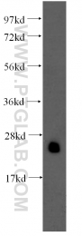 60036-2-Ig - Triosephosphate isomerase (TPI1)