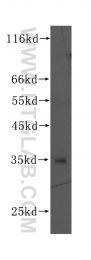 60036-2-Ig - Triosephosphate isomerase (TPI1)